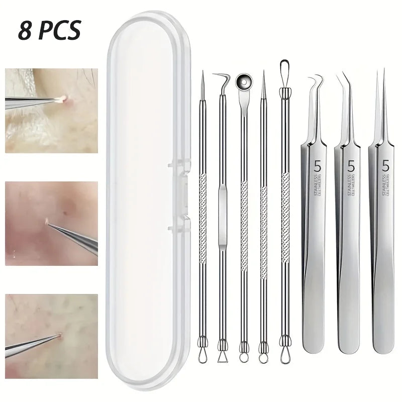 Kit Extrator de Cravos e Espinhas Inox Extracao Profissional